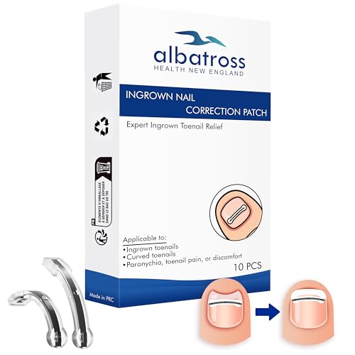 Best Tools for Ingrown Toenails