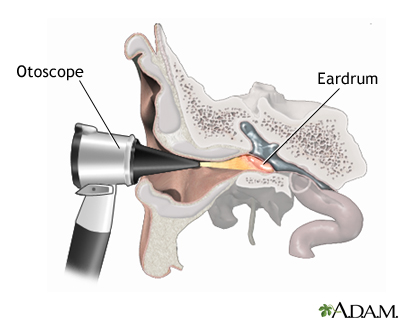 What is the Tool Doctors Use to Look in Ears